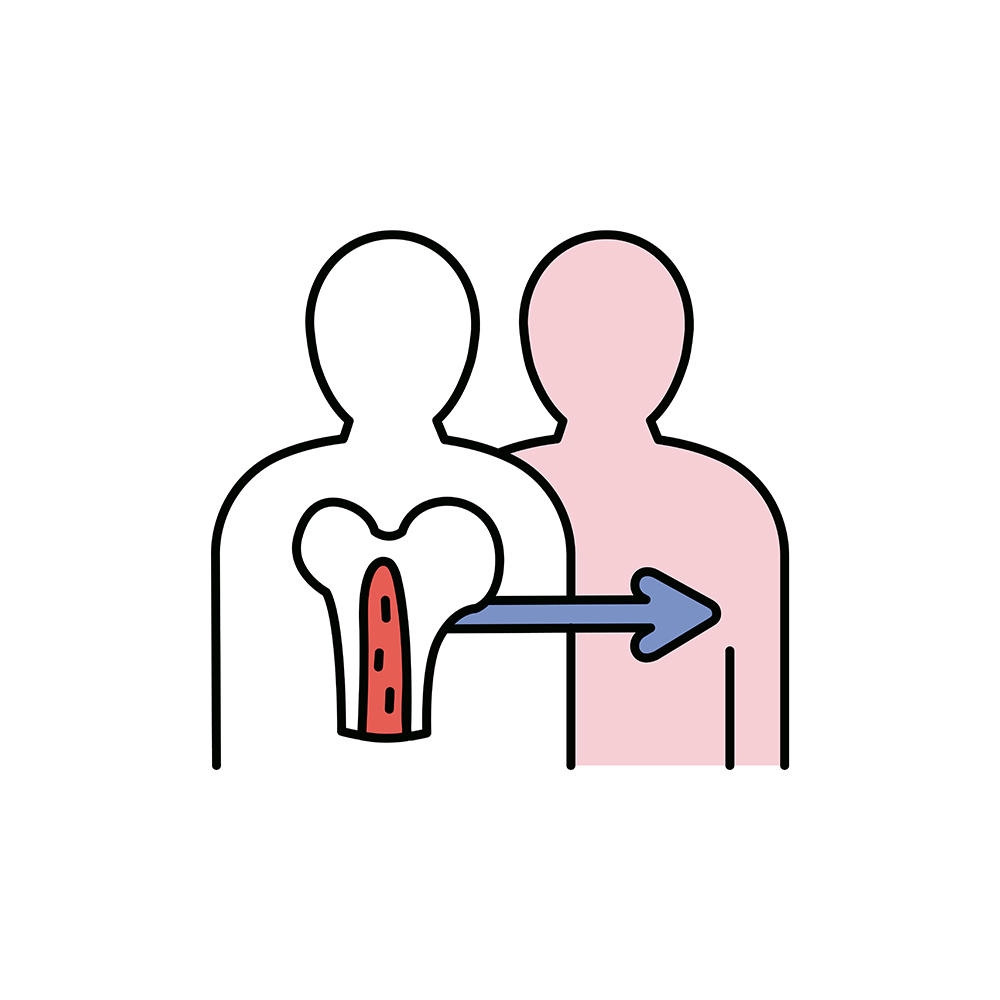 Transplante de medula óssea alogênico