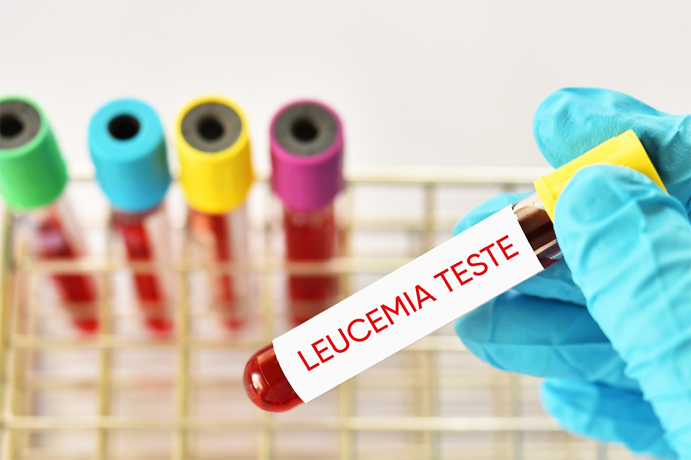 Leucemia aguda