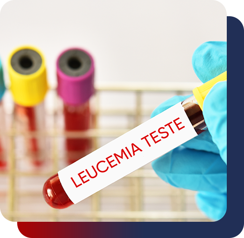 Leucemia aguda