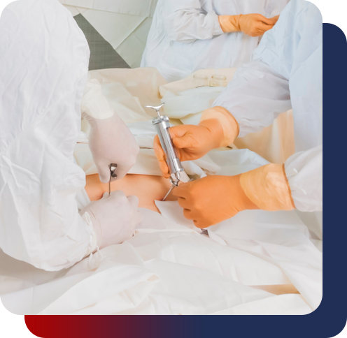 Transplante de medula óssea autólogo