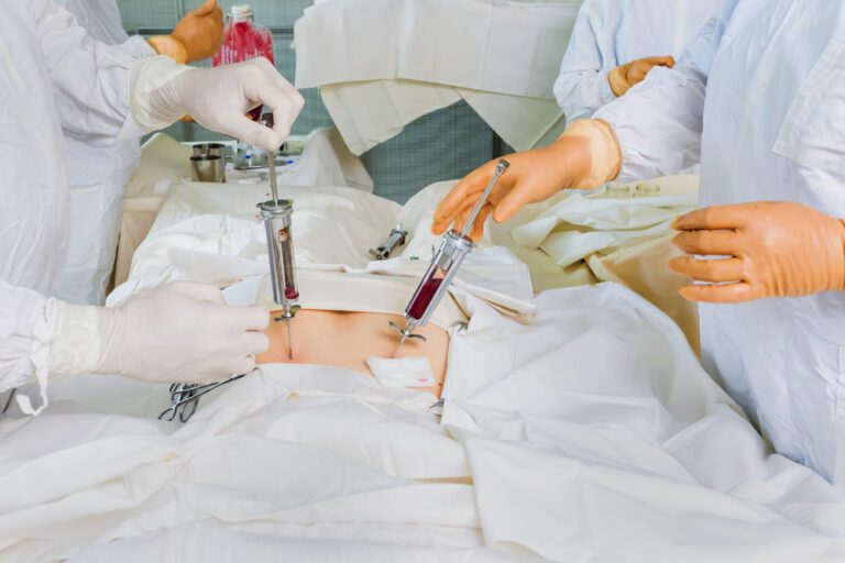 Complicações pós-transplante de medula óssea