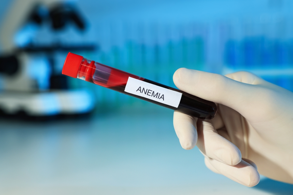 Quais são os tipos de anemia?